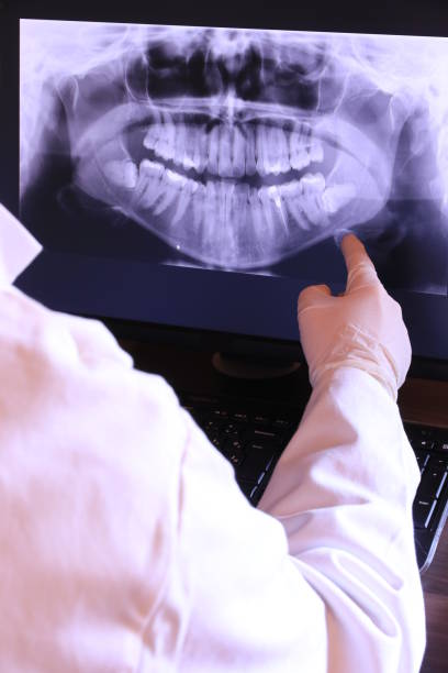 Best Emergency Dental Extractions in Tarpon Springs, FL